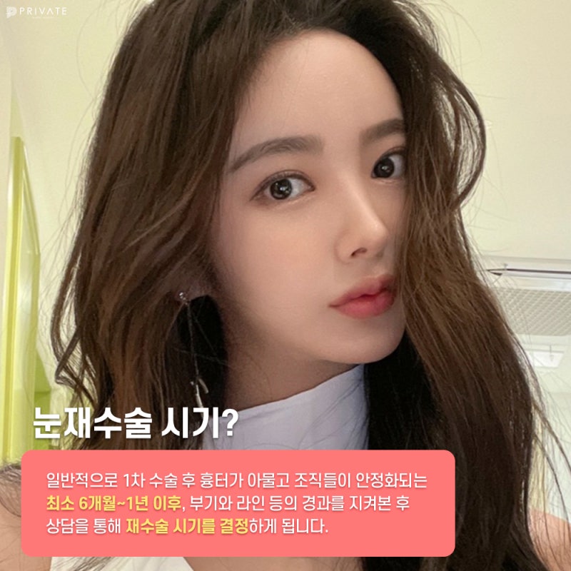 눈재수술잘하는곳 신사 프라이빗성형외과 사진 4