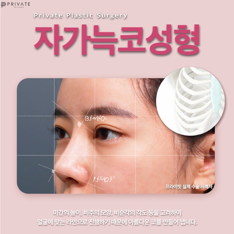 자가늑 코수술 고민이라면, 프라이빗성형외과