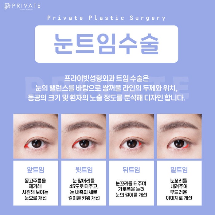 눈트임잘하는곳 신사 프라이빗성형외과