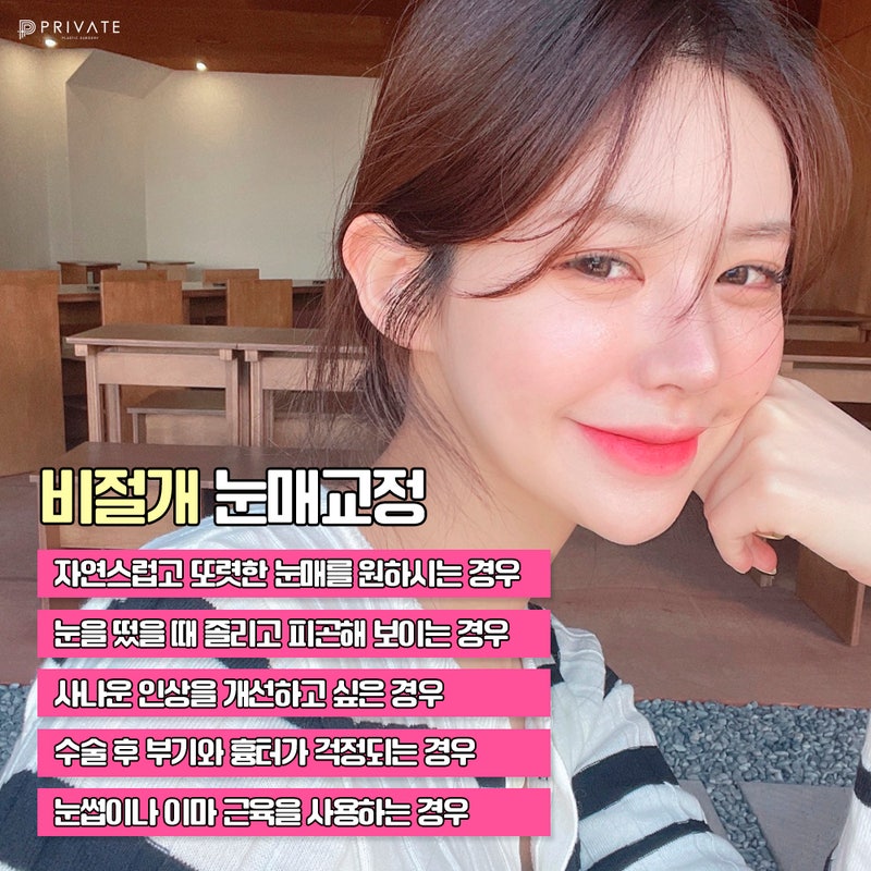 비절개눈매교정수술 잘하는곳 프라이빗성형외과