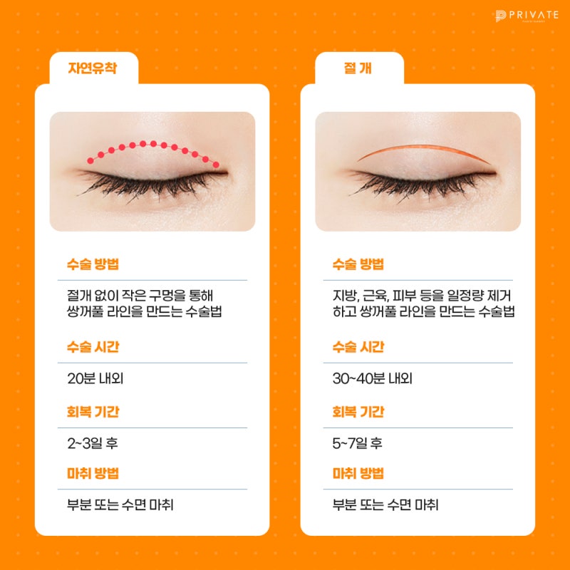 쌍수 절개 후기가 좋은 프라이빗성형외과