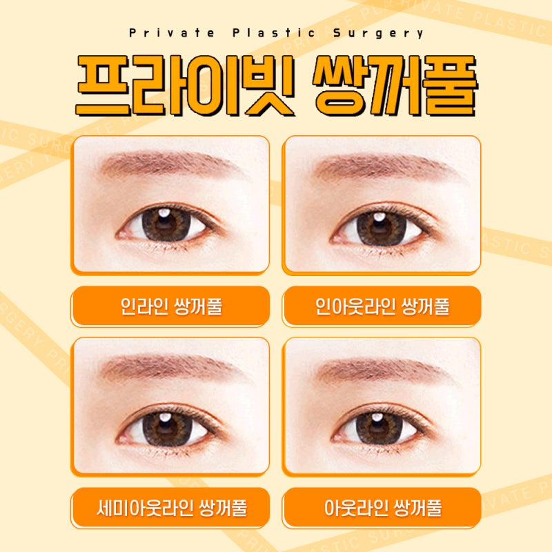 쌍수 절개 후기가 좋은 프라이빗성형외과 사진 4