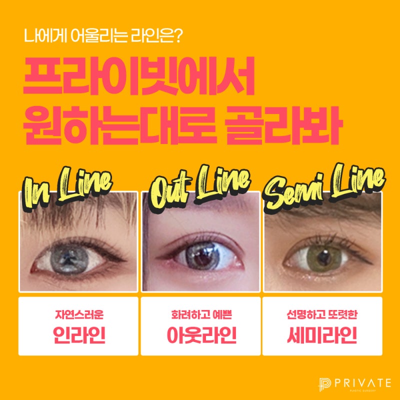 Tempat Terbaik untuk Operasi Kelopak Mata Ganda Alami adalah Private Plastic Surgery 사진 4