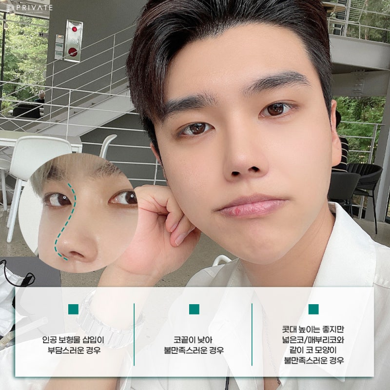 프라이빗성형외과 남자코끝성형수술 사진 5