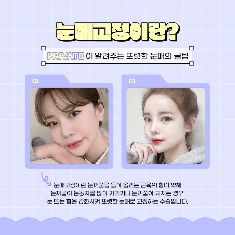 눈매교정쌍수 만족도 높은 프라이빗성형외과