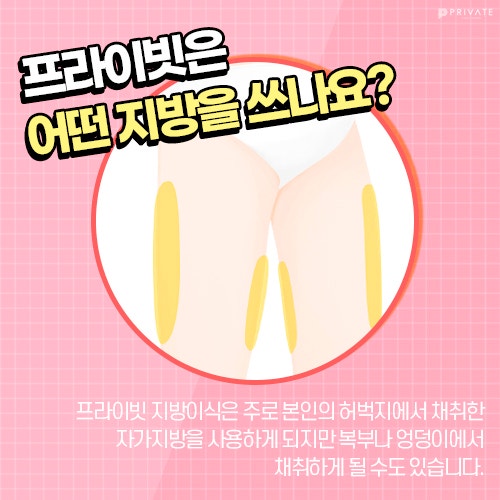얼굴지방이식전후 차이가 궁금하다면, 프라이빗성형외과 사진 4
