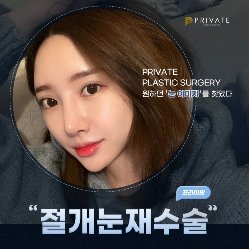 신사 눈재수술잘하는곳 프라이빗성형외과 알아보기 사진 2