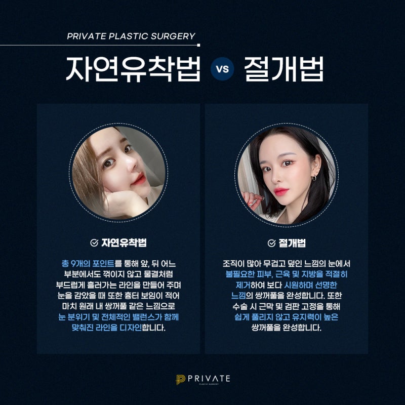 신사 눈재수술잘하는곳 프라이빗성형외과 알아보기 사진 4