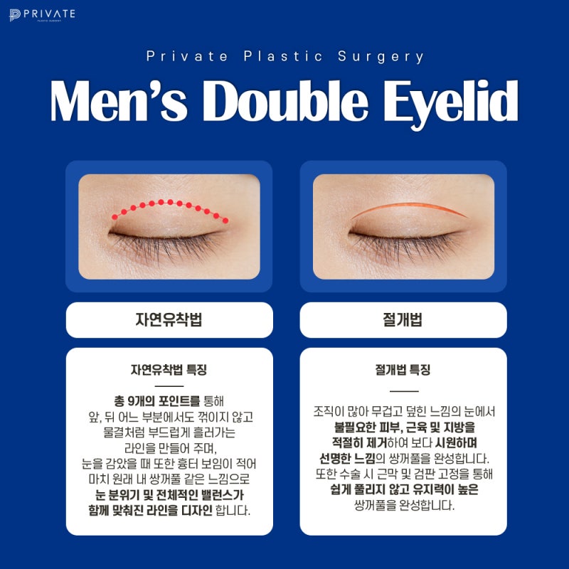 남자 눈 성형수술은 프라이빗성형외과