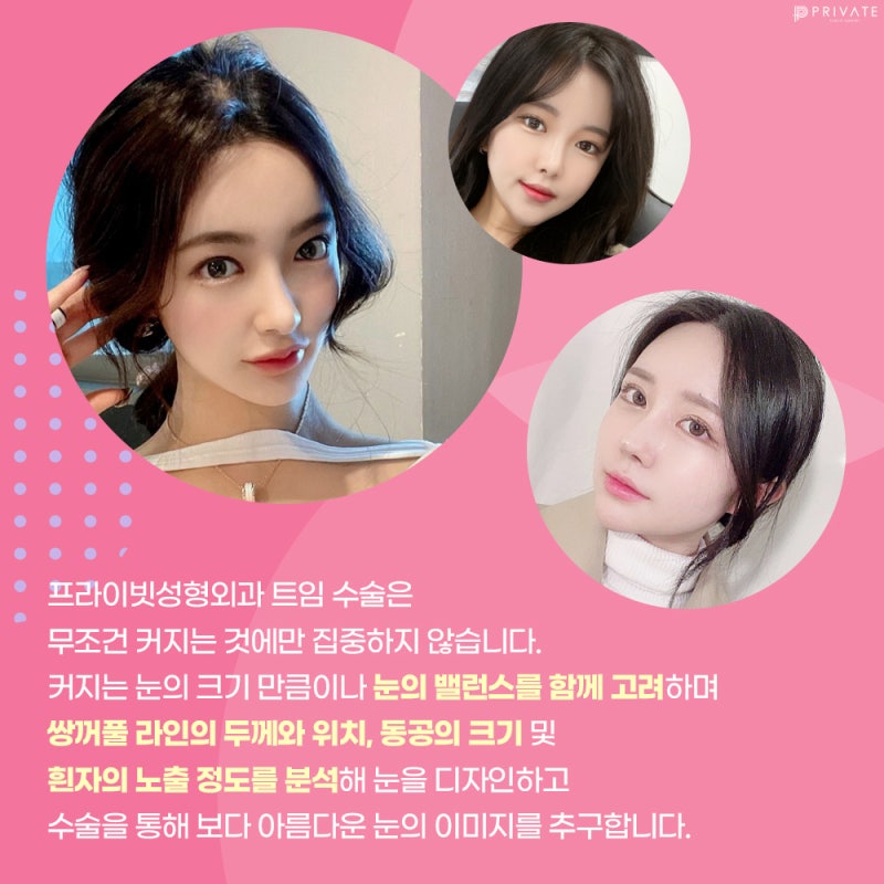 풀트임성형수술은 프라이빗성형외과