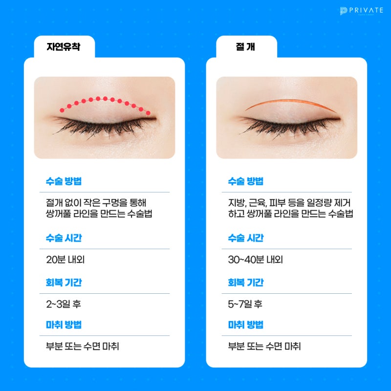 了解Private整形外科的双眼皮切开术