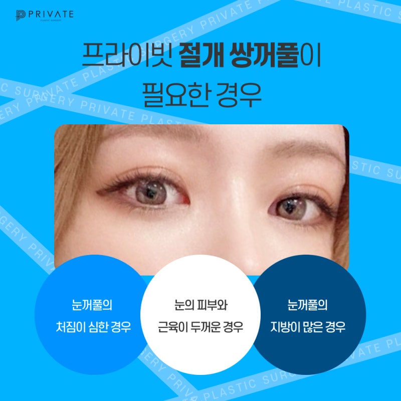 了解Private整形外科的双眼皮切开术 사진 5