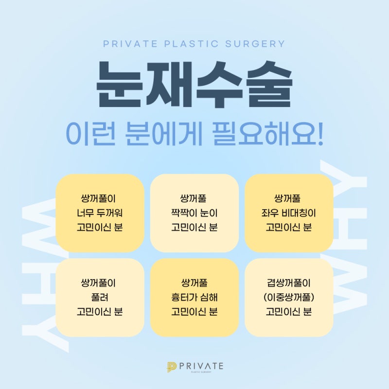 쌍수 재수술 후기가 좋은 프라이빗성형외과 사진 6