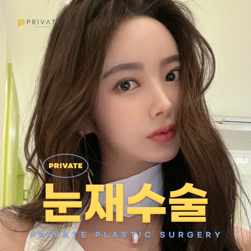 쌍수 재수술 후기가 좋은 프라이빗성형외과 사진 2