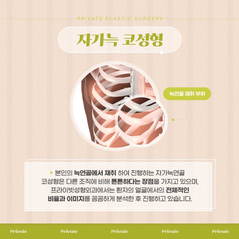 코수술 자가늑, 프라이빗성형외과에서 알아보기 사진 3