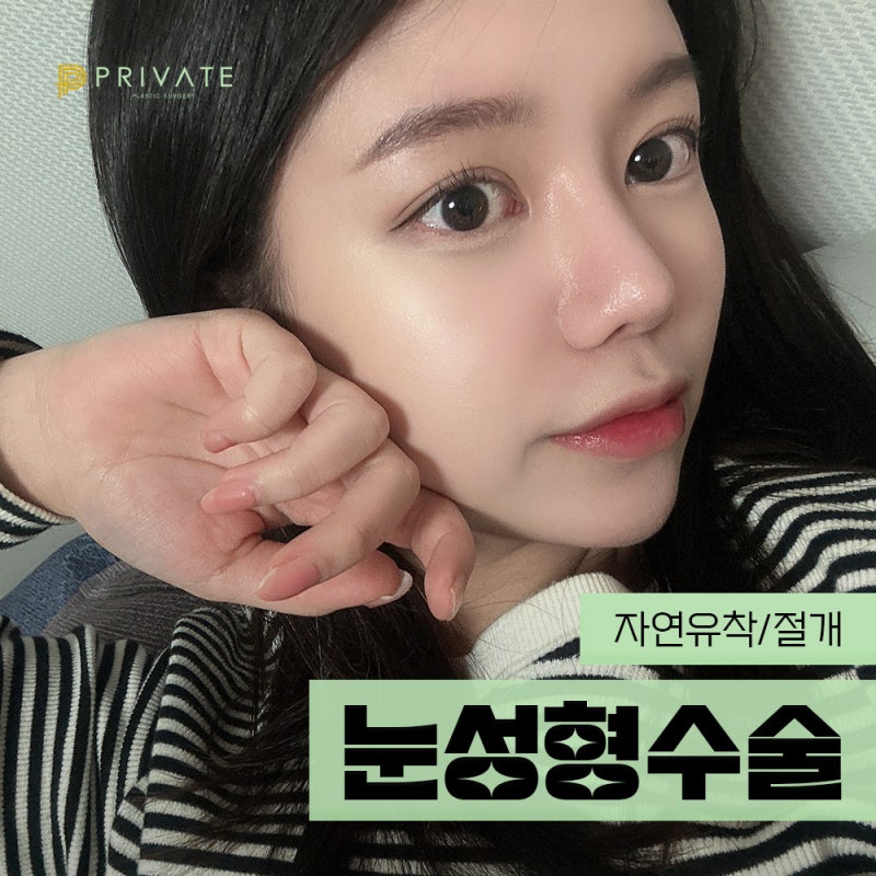 눈성형잘하는병원 신사역 프라이빗성형외과 사진 2