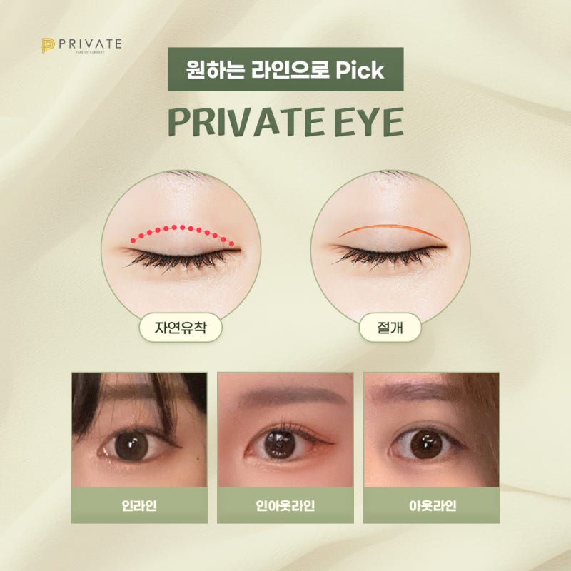 쌍수 재수술 후기 좋은 곳 찾고 있다면 프라이빗성형외과 사진 4