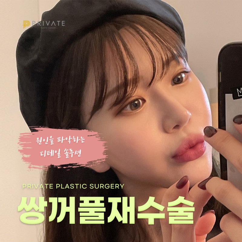 쌍수 재수술 후기 좋은 곳 찾고 있다면 프라이빗성형외과 사진 2
