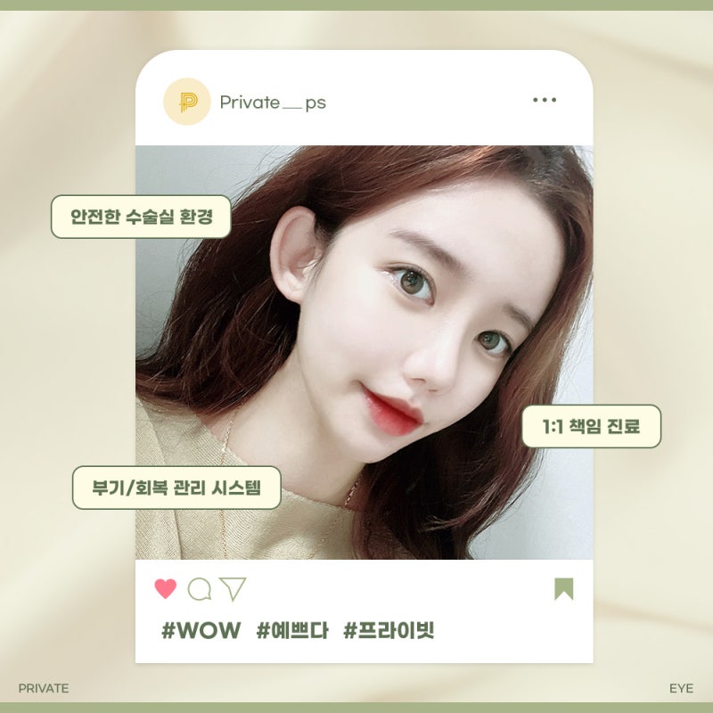 쌍수 재수술 후기 좋은 곳 찾고 있다면 프라이빗성형외과 사진 6