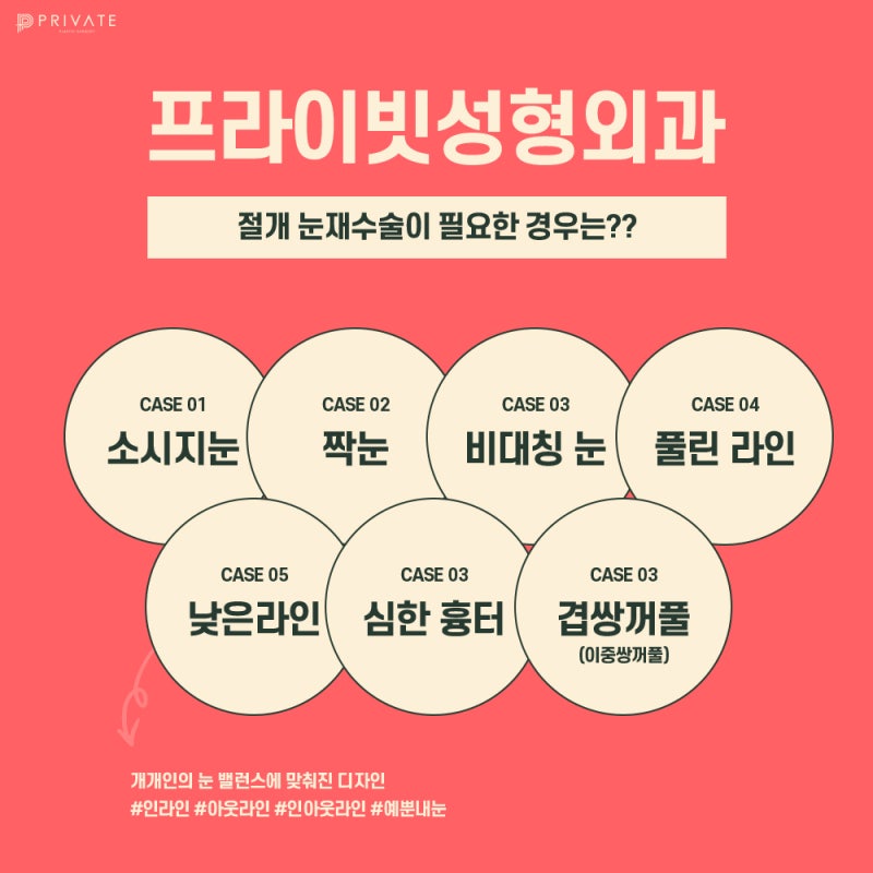 Operasi Rekonstruksi Mata di Sinsa Private Plastic Surgery, Tempat Terkenal 사진 4