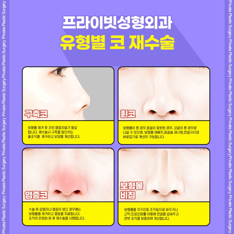 코재수술병원은 신사 프라이빗성형외과 사진 4