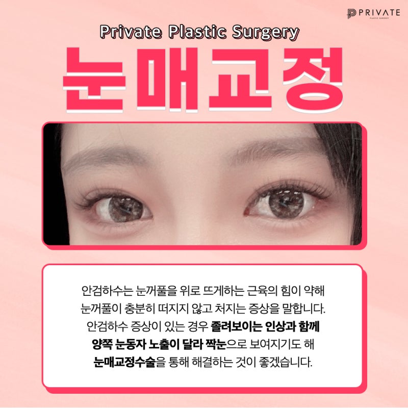 Tempat Terbaik untuk Koreksi Ptosis Mata: Private Plastic Surgery