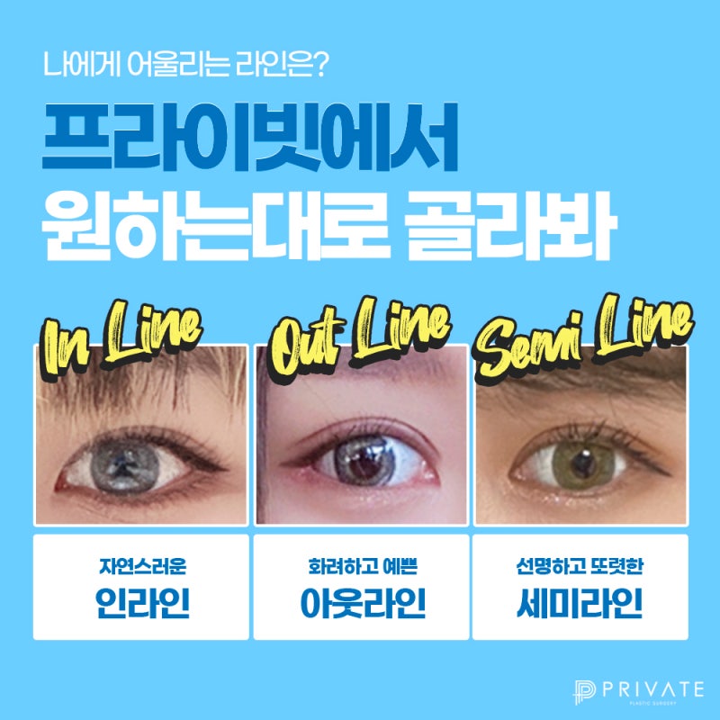 Perbedaan Sebelum dan Sesudah Operasi Kelopak Mata Ganda yang Baik di Private Plastic Surgery Sinsa 사진 5