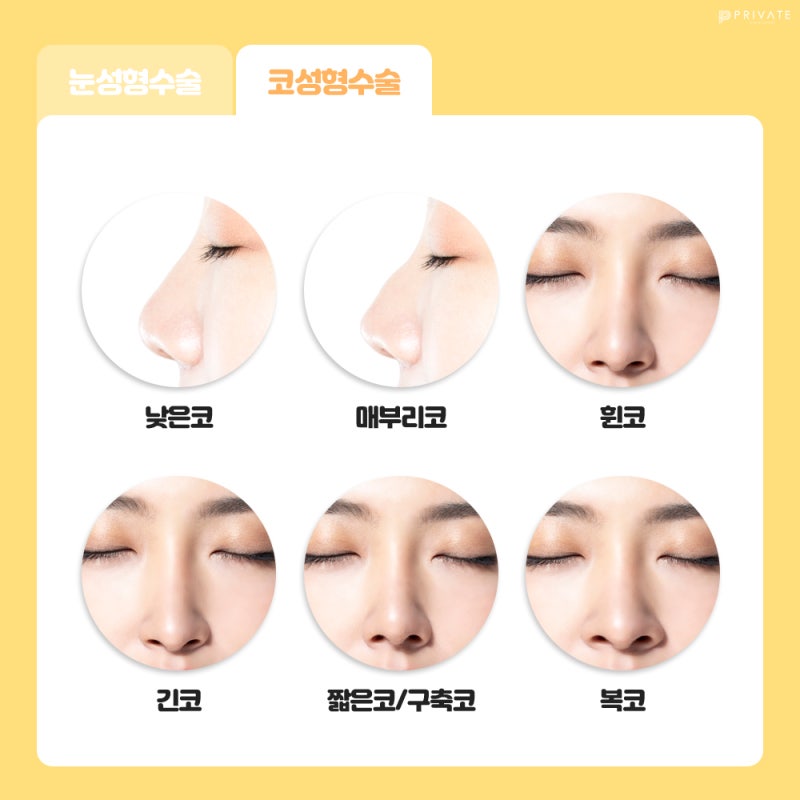 Событие CSAT, Private Plastic Surgery 사진 5