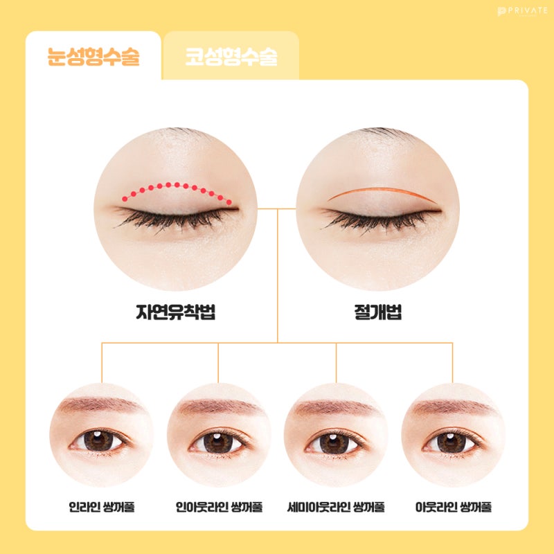 Событие CSAT, Private Plastic Surgery 사진 4