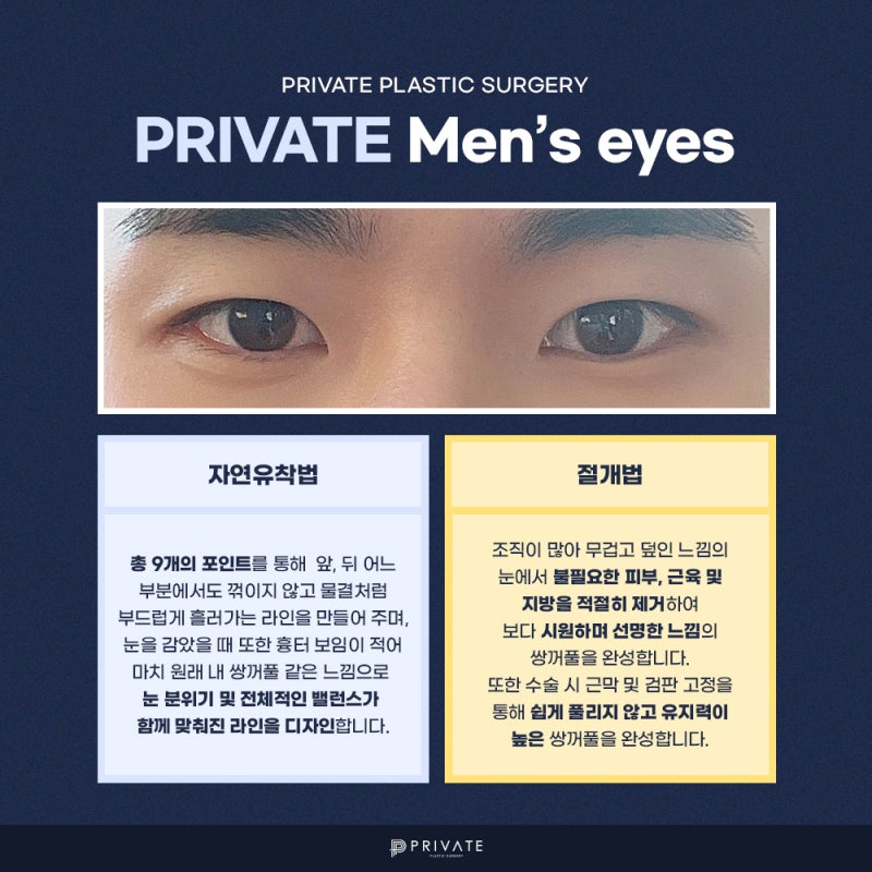 남자 눈수술 잘하는병원은 신사 프라이빗성형외과 사진 4