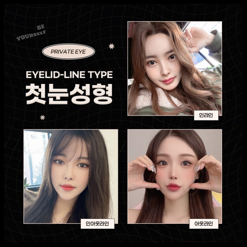 Operasi Plastik Mata Pertama di Private Plastic Surgery Sinsa Station 사진 5