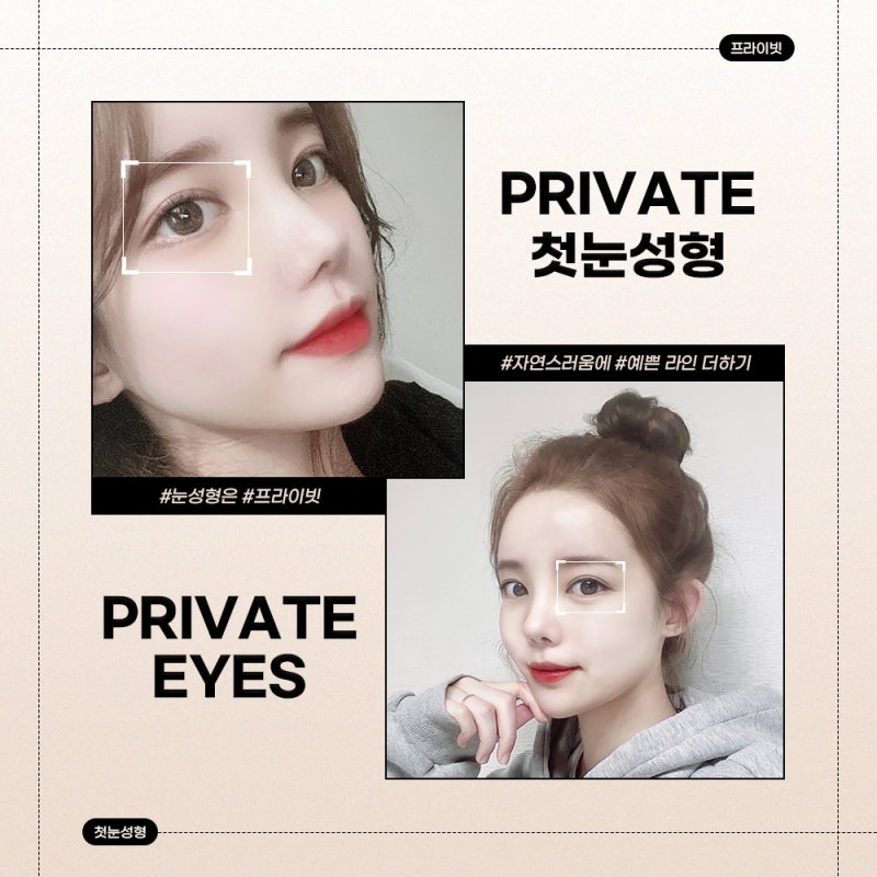 Operasi Plastik Mata Pertama di Private Plastic Surgery Sinsa Station 사진 6