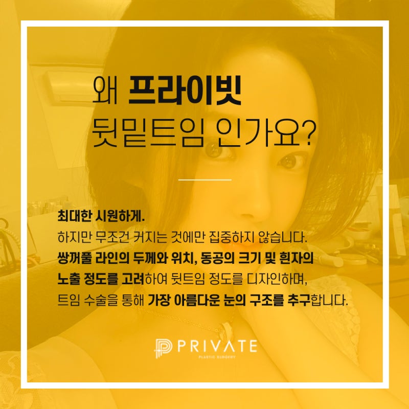 Ulasan Bagus Operasi Canthoplasty Lateral dan Epicanthoplasty Lateral di Private Plastic Surgery Sinsa-dong 사진 6