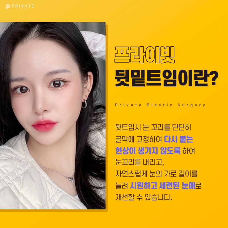 Ulasan Bagus Operasi Canthoplasty Lateral dan Epicanthoplasty Lateral di Private Plastic Surgery Sinsa-dong 사진 3