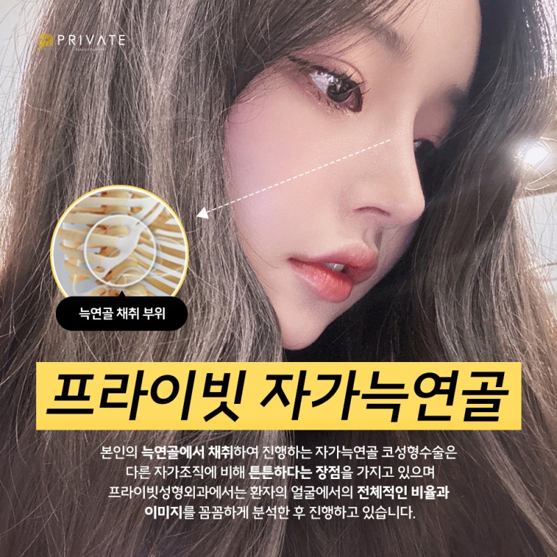 자가늑 코수술 후기 좋은 프라이빗성형외과