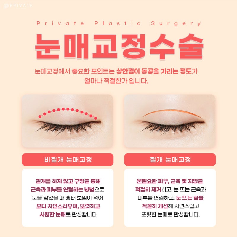 눈매교정술 프라이빗성형외과에서 알아보기 사진 5