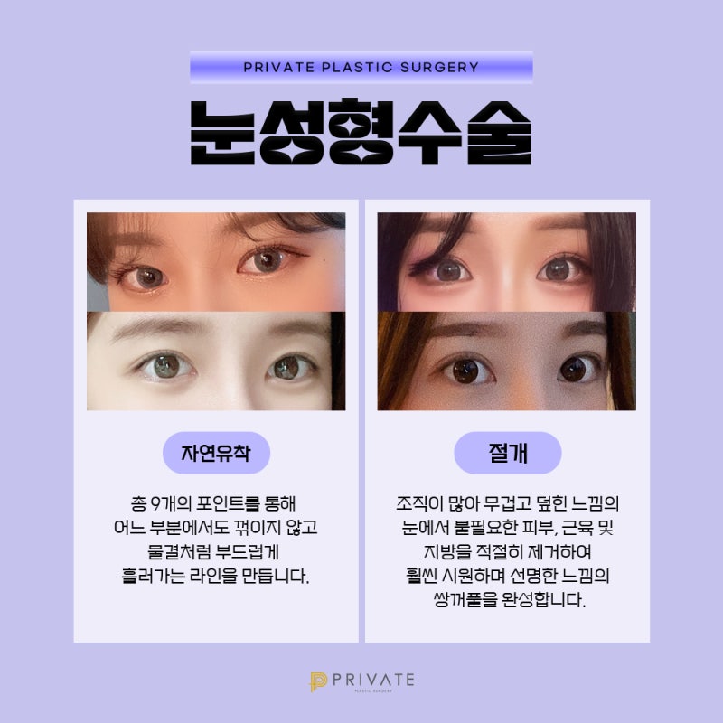 쌍수잘하는곳 신사 프라이빗성형외과 사진 4