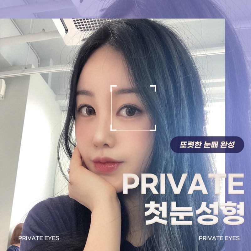 쌍수잘하는곳 신사 프라이빗성형외과 사진 2