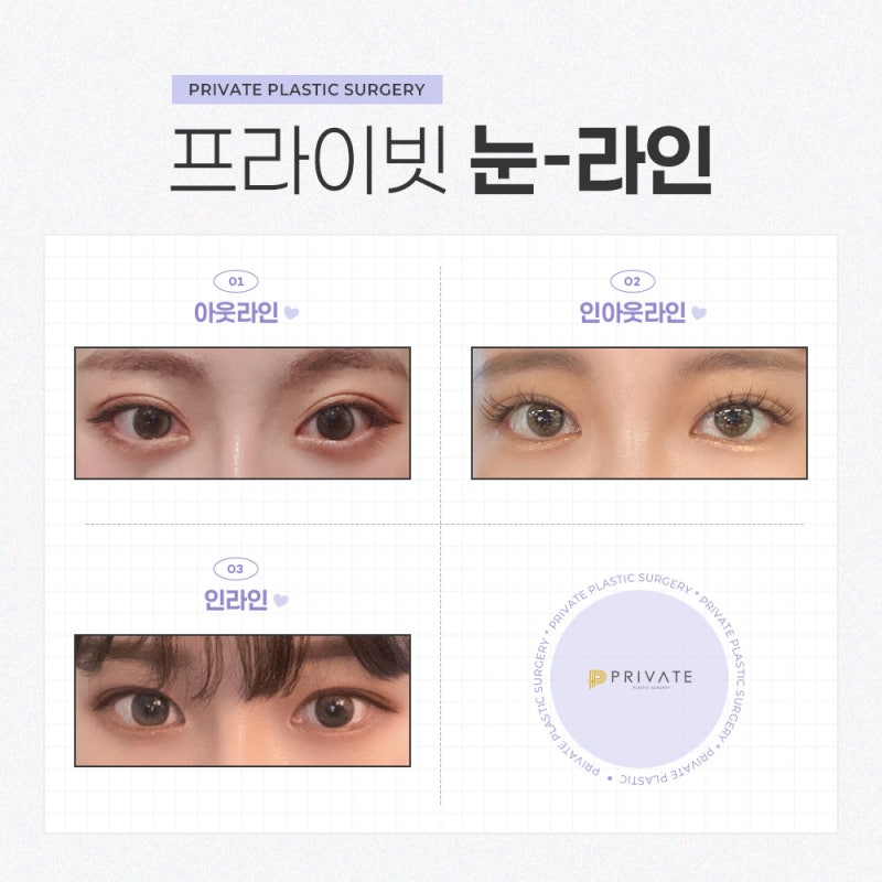 눈재수술잘하는곳은 신사 프라이빗성형외과 사진 4