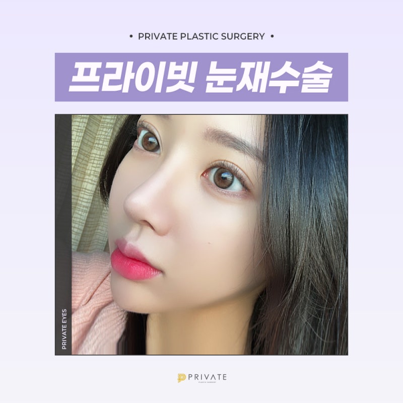 눈재수술잘하는곳은 신사 프라이빗성형외과 사진 2