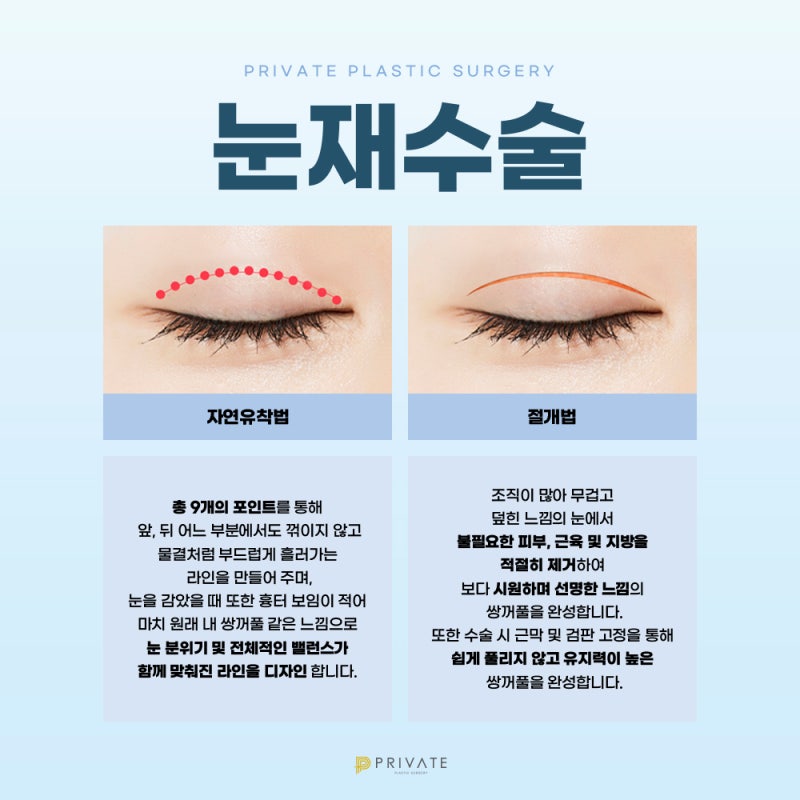 자연유착 재수술 후기 좋은 프라이빗성형외과 사진 4