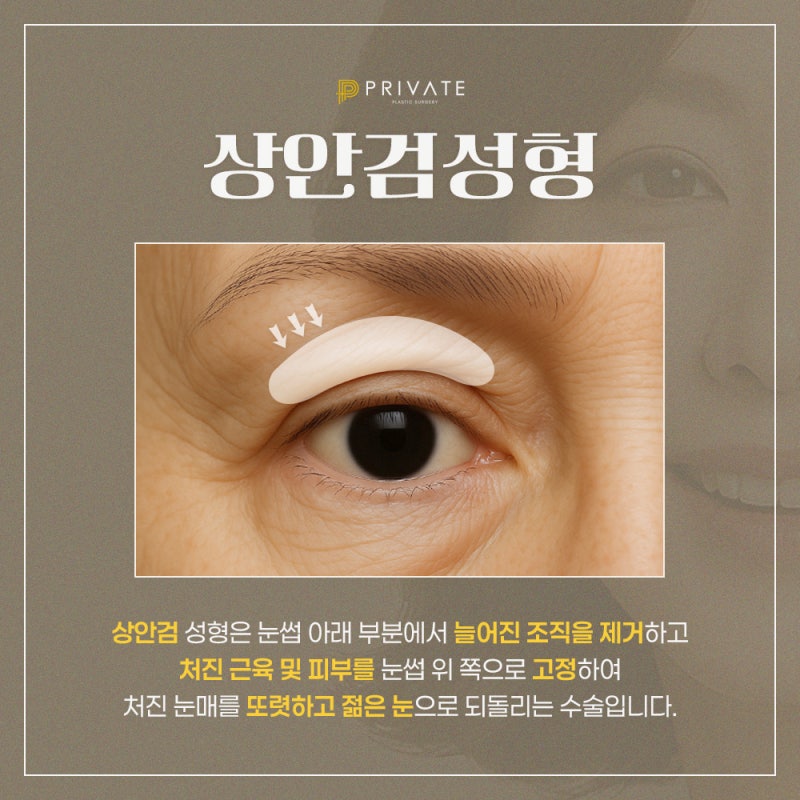 상안검수술은 신사역 프라이빗성형외과