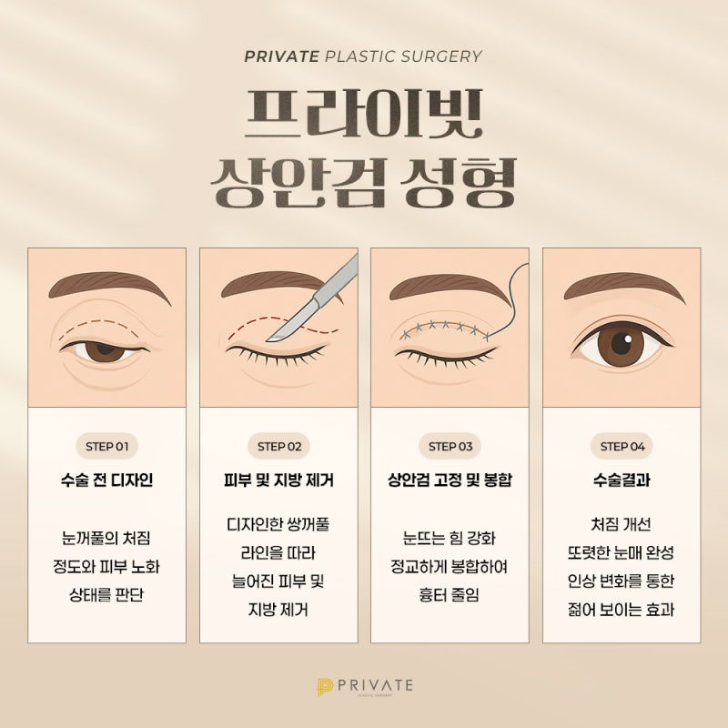 상안검수술은 신사역 프라이빗성형외과 사진 5