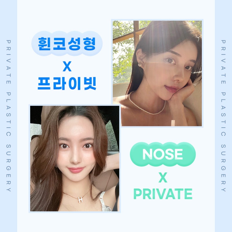 휜코 수술 후기가 좋은 신사 프라이빗성형외과 사진 6