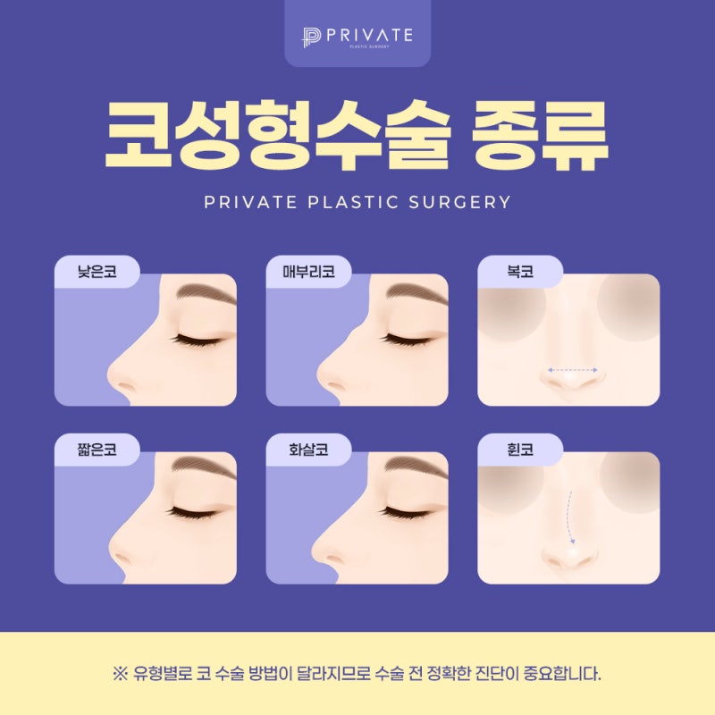 코수술잘하는병원은 신사 프라이빗성형외과 사진 4