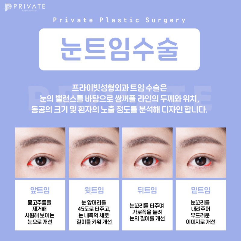 눈트임잘하는곳은 프라이빗성형외과