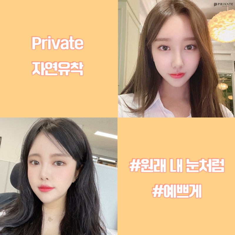 자연유착쌍꺼풀후기는 프라이빗성형외과 사진 6