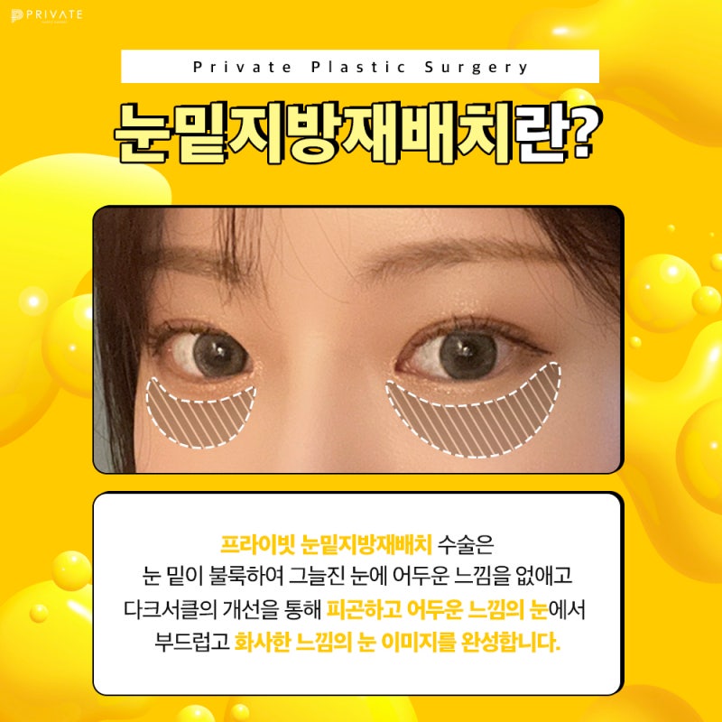 눈밑지 수술 후기 좋은 프라이빗성형외과