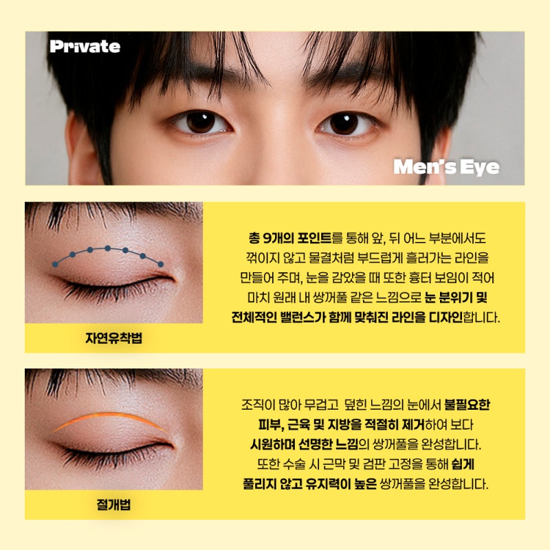 남자 쌍수 재수술 잘하는곳 프라이빗성형외과 사진 4