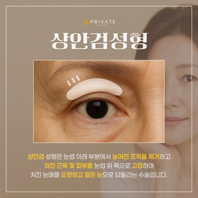 상안검수술후기 확인은 프라이빗성형외과